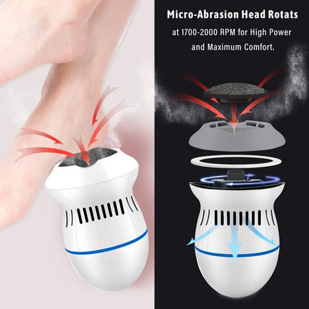 Revitalize Your Feet with the Rechargeable Electric Foot File