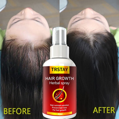 HAIR GROWTH SERUM SPRAY FAST LIQUID TREATMENT HAIR CARE