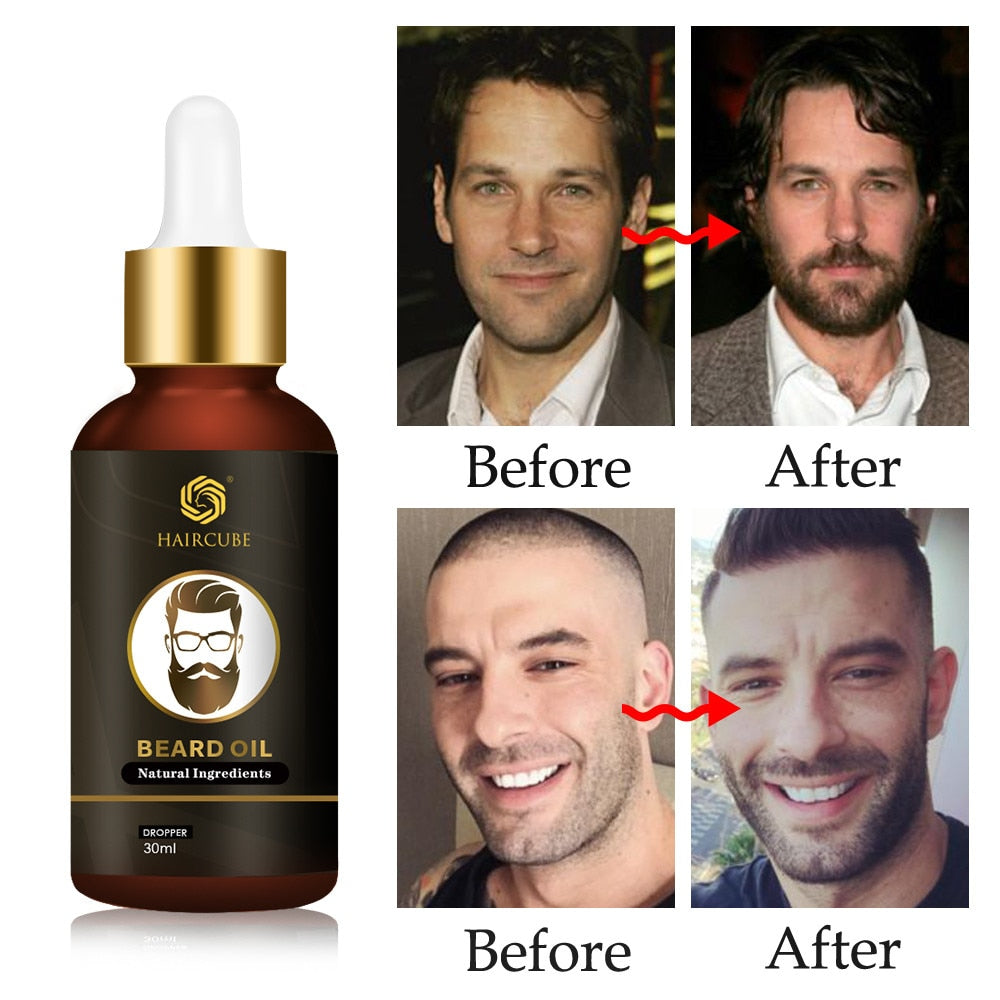 BEARD GROWTH OIL PRODUCTS FOR HAIR LOSS.