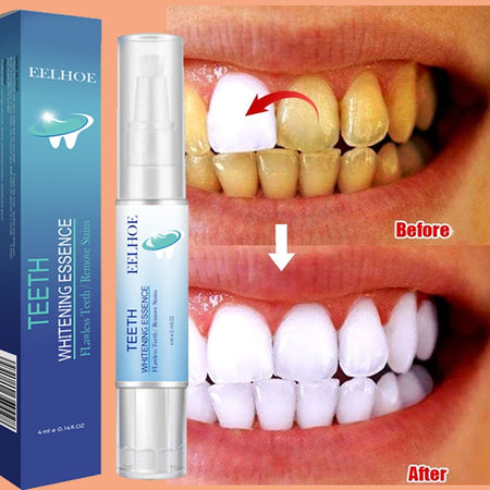 New Teeth Whitening Pen Tooth Gel Whitener Bleach Remove Stains intant smile