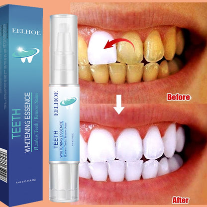 New Teeth Whitening Pen Tooth Gel Whitener Bleach Remove Stains intant smile